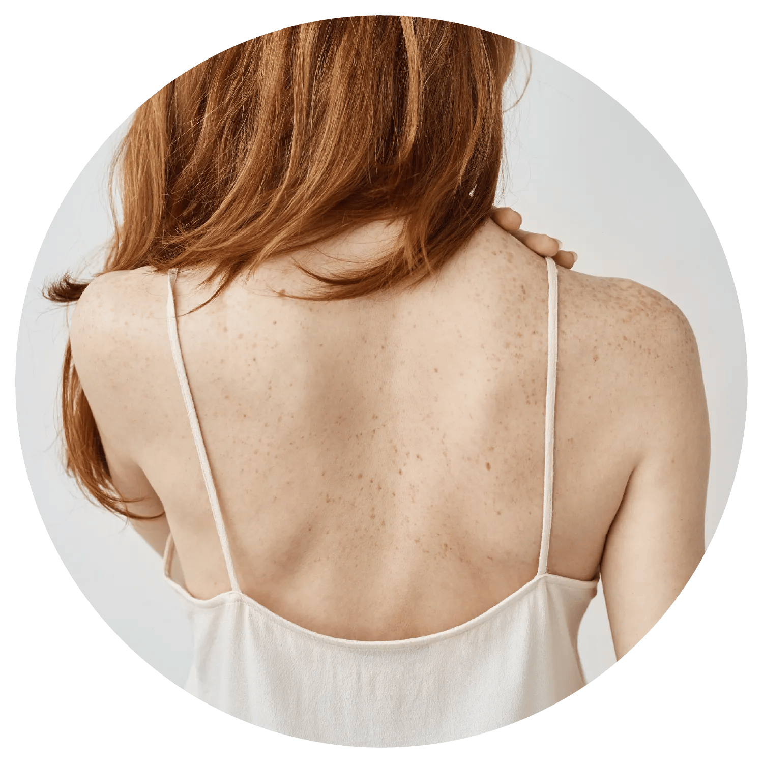Back Acne treatment results at Toronto medical spa - The Chain Reaction of Symptoms